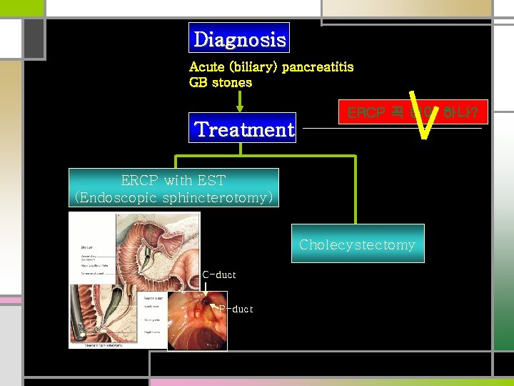 Diagnosis Acute (biliary) pancreatitis GB stones Treatment ERCP 꼭 해야 하나? ERCP with EST