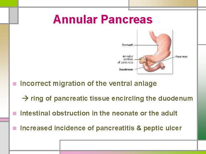 Annular Pancreas n Incorrect migration of the ventral anlage ring of pancreatic tissue encircling