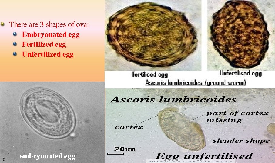 There are 3 shapes of ova: Embryonated egg Fertilized egg Unfertilized egg embryonated egg