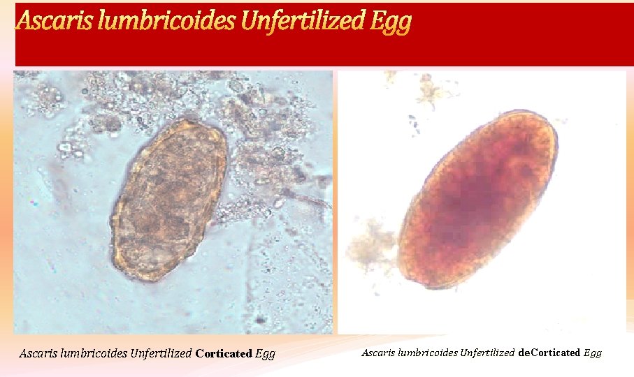 Ascaris lumbricoides Unfertilized Egg Ascaris lumbricoides Unfertilized Corticated Egg Ascaris lumbricoides Unfertilized de. Corticated