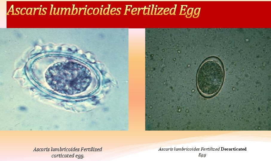 Ascaris lumbricoides Fertilized Egg Ascaris lumbricoides Fertilized corticated egg. Ascaris lumbricoides Fertilized Decorticated Egg