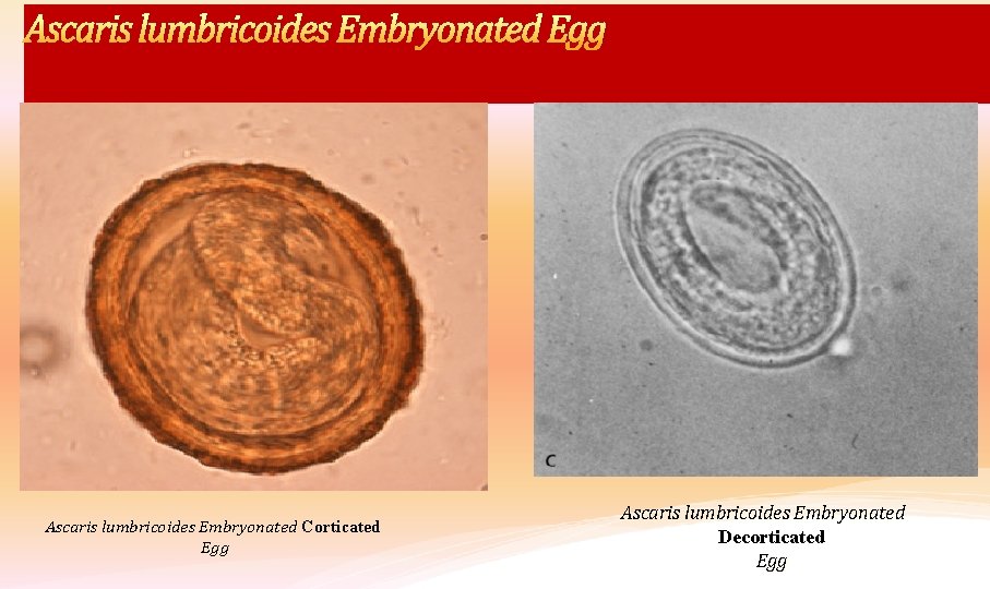 Ascaris lumbricoides Embryonated Egg Ascaris lumbricoides Embryonated Corticated Egg Ascaris lumbricoides Embryonated Decorticated Egg