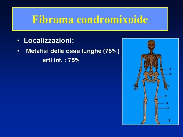 Fibroma condromixoide • Localizzazioni: • Metafisi delle ossa lunghe (75%) arti inf. : 75%