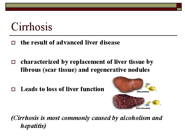 Cirrhosis o the result of advanced liver disease o characterized by replacement of liver