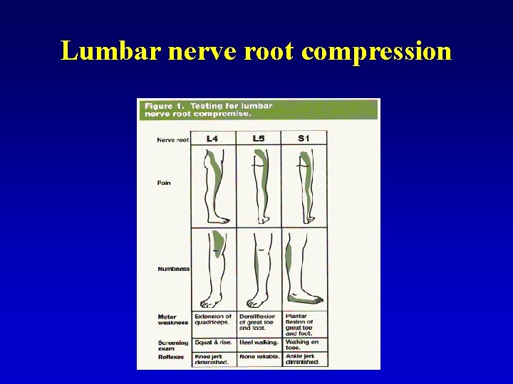 Lumbar nerve root compression 