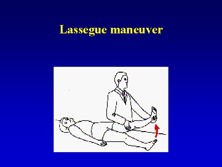 Lassegue maneuver 