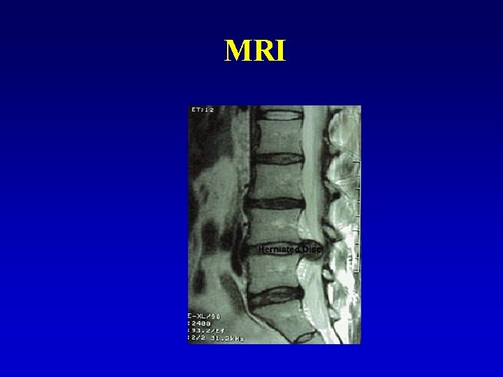 MRI 