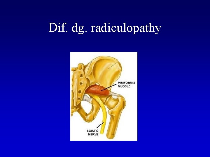 Dif. dg. radiculopathy 