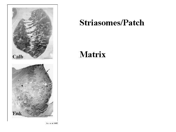 Striasomes/Patch Matrix 