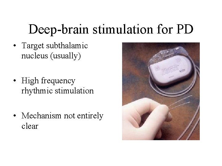 Deep-brain stimulation for PD • Target subthalamic nucleus (usually) • High frequency rhythmic stimulation