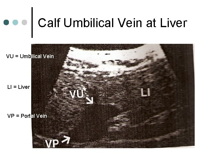 Calf Umbilical Vein at Liver VU = Umbilical Vein LI = Liver VP =