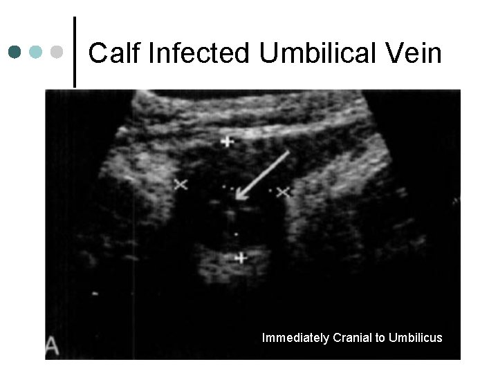 Calf Infected Umbilical Vein Immediately Cranial to Umbilicus 