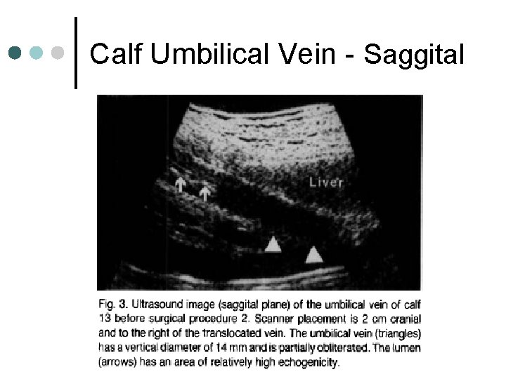 Calf Umbilical Vein - Saggital 