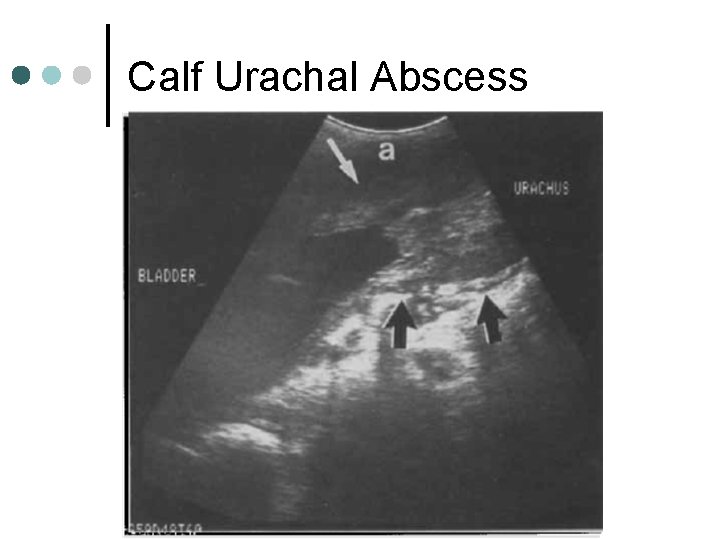 Calf Urachal Abscess 