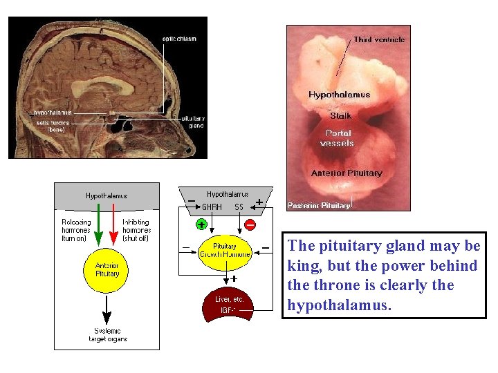 The pituitary gland may be king, but the power behind the throne is clearly