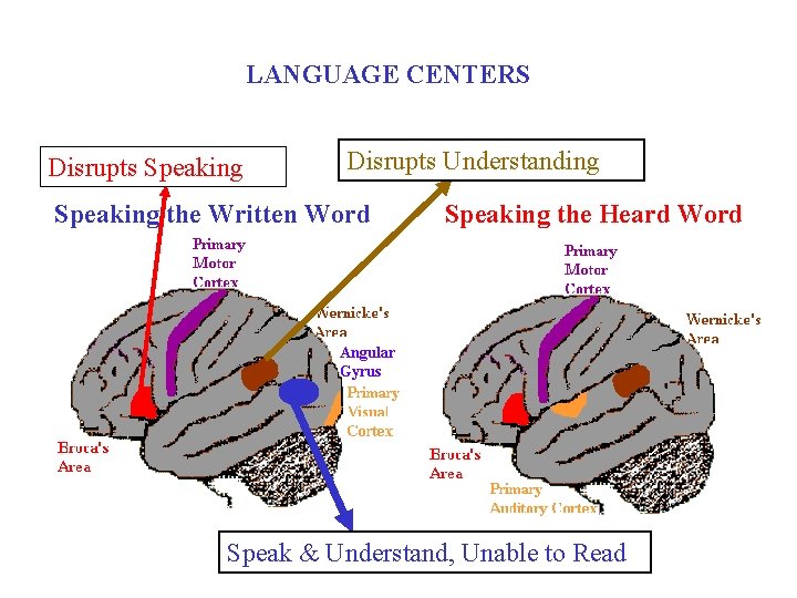LANGUAGE CENTERS Disrupts Speaking Disrupts Understanding Speaking the Written Word Speaking the Heard Word