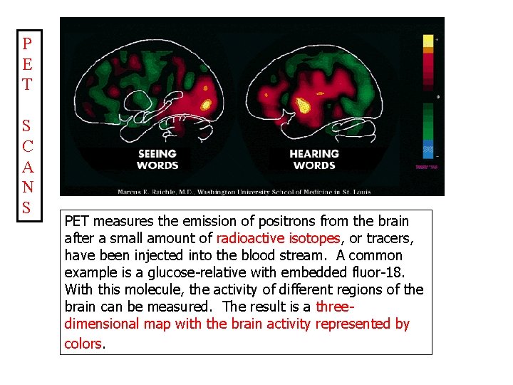 P E T S C A N S PET measures the emission of positrons