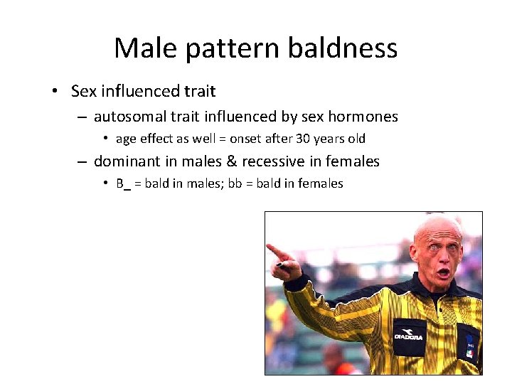 Male pattern baldness • Sex influenced trait – autosomal trait influenced by sex hormones