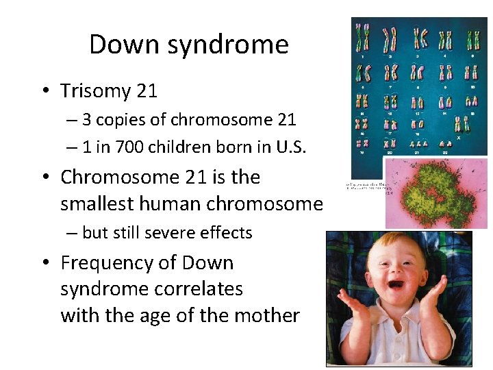 Down syndrome • Trisomy 21 – 3 copies of chromosome 21 – 1 in