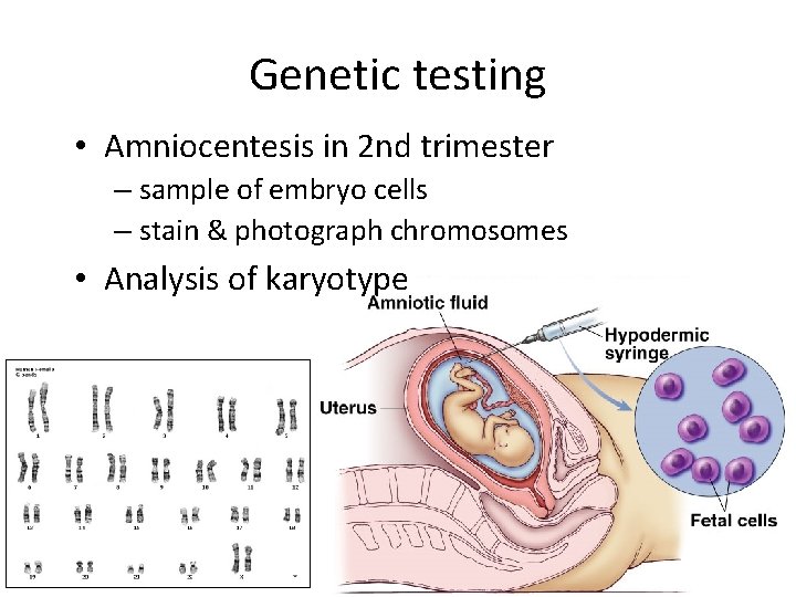 Genetic testing • Amniocentesis in 2 nd trimester – sample of embryo cells –