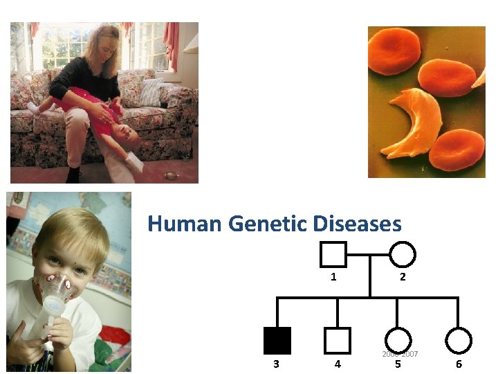 Human Genetic Diseases 1 3 4 2 2006 -2007 5 6 