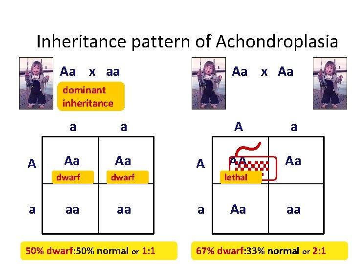 Inheritance pattern of Achondroplasia Aa x aa Aa x Aa dominant inheritance A a
