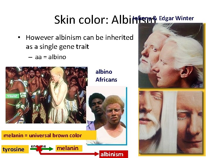 Johnny & Edgar Winter Skin color: Albinism • However albinism can be inherited as