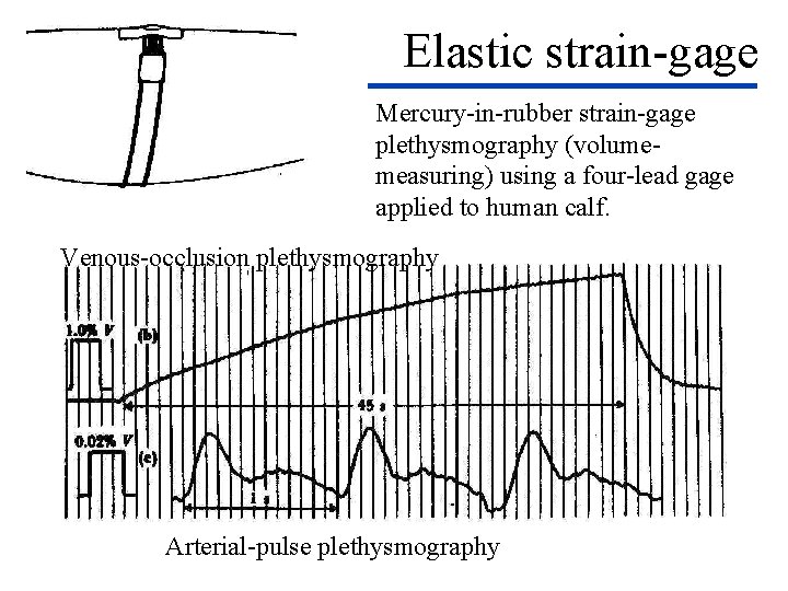 Elastic strain-gage Mercury-in-rubber strain-gage plethysmography (volumemeasuring) using a four-lead gage applied to human calf.