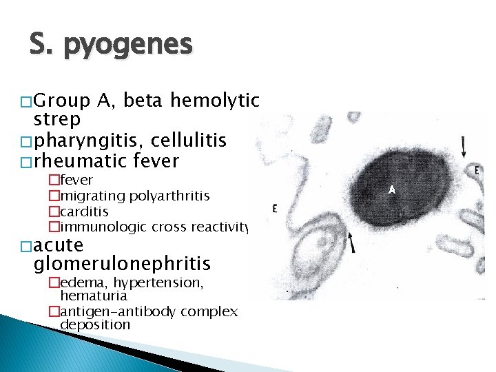 S. pyogenes � Group A, beta hemolytic strep � pharyngitis, cellulitis � rheumatic fever