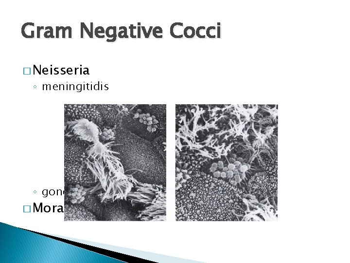 Gram Negative Cocci � Neisseria ◦ meningitidis ◦ gonorrhea � Moraxella catarrhalis 