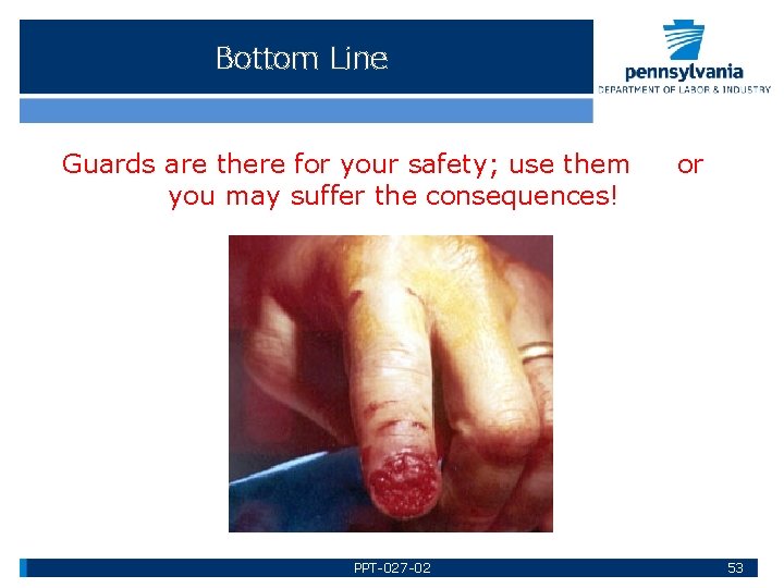 Bottom Line Guards are there for your safety; use them you may suffer the