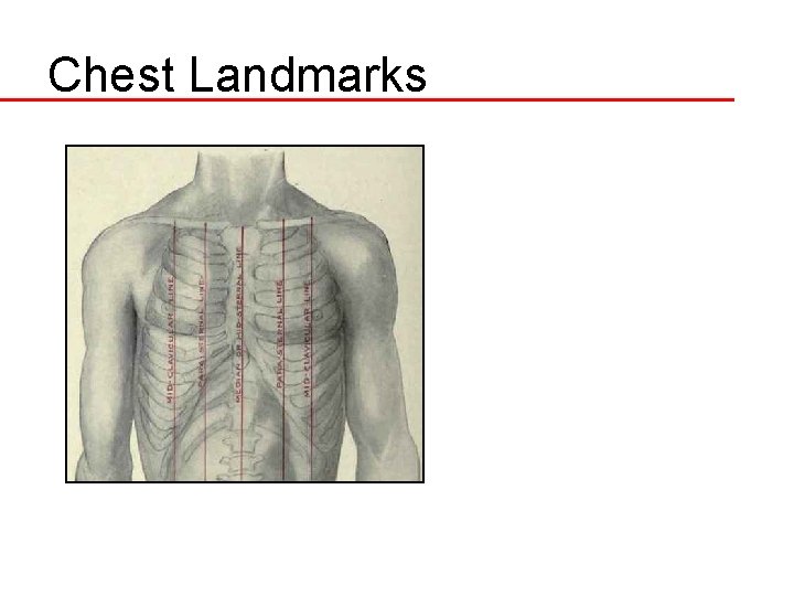 Chest Landmarks 