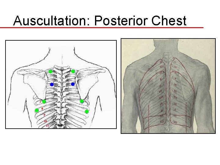Auscultation: Posterior Chest 