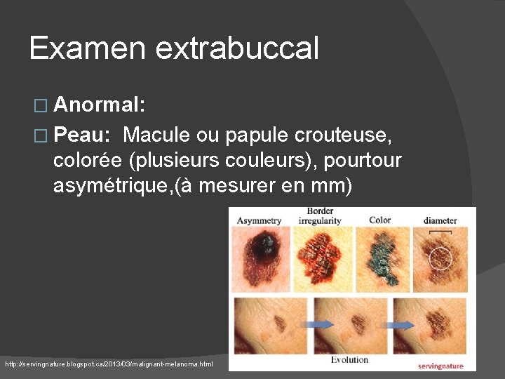 Examen extrabuccal � Anormal: � Peau: Macule ou papule crouteuse, colorée (plusieurs couleurs), pourtour