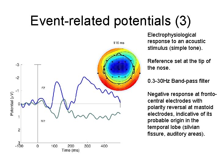 Event-related potentials (3) Electrophysiological response to an acoustic stimulus (simple tone). Reference set at