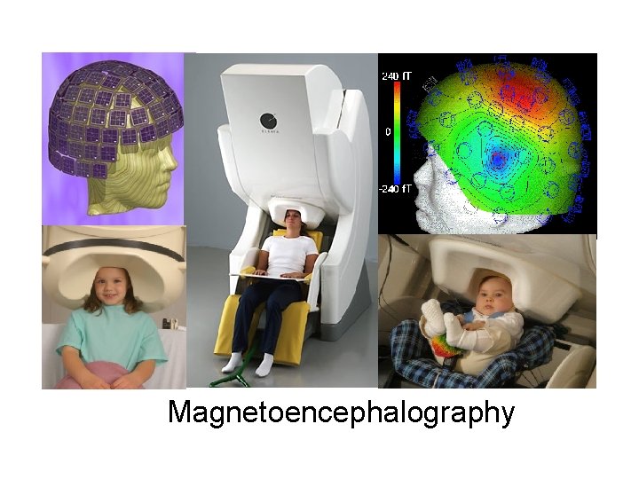 Magnetoencephalography 