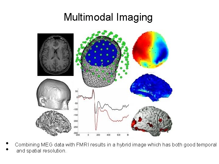 Multimodal Imaging • • Combining MEG data with FMRI results in a hybrid image