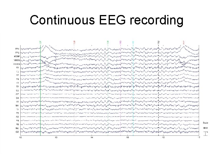Continuous EEG recording 