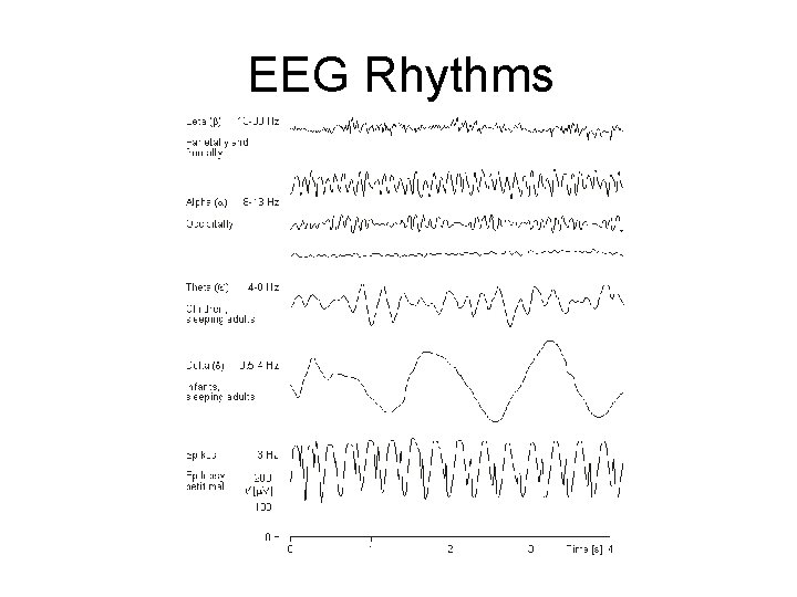 EEG Rhythms 