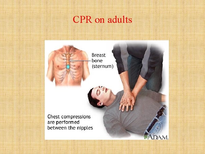 CPR on adults 