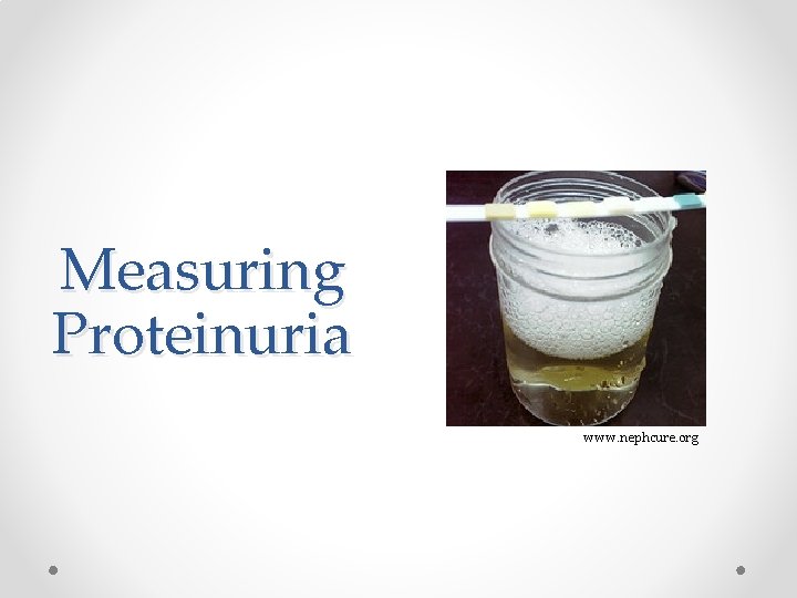 Measuring Proteinuria www. nephcure. org 