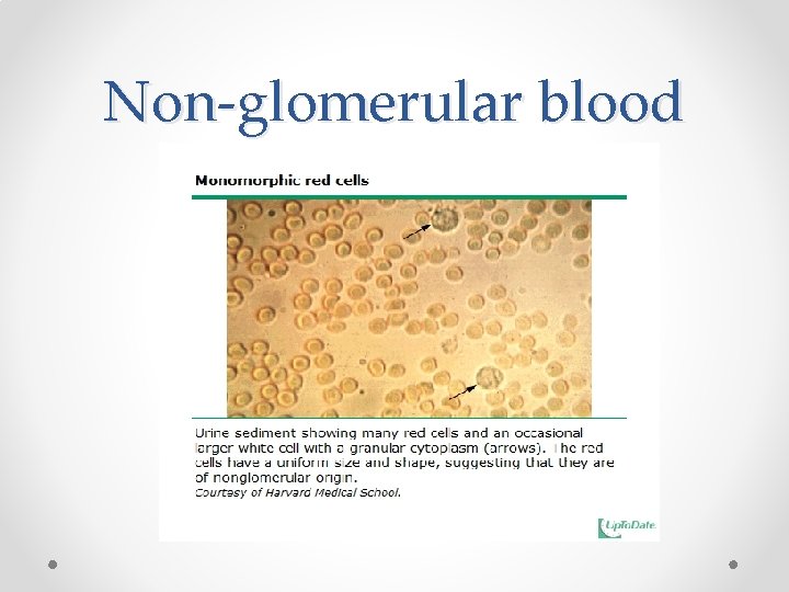 Non-glomerular blood 