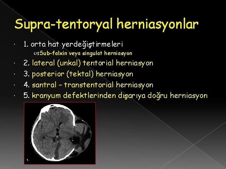 Supra-tentoryal herniasyonlar 1. orta hat yerdeğiştirmeleri Sub-falxin veya singulat herniasyon 2. lateral (unkal) tentorial