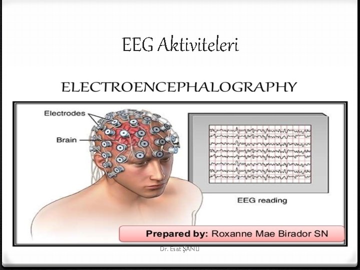 EEG Aktiviteleri Dr. Esat ŞANLI 