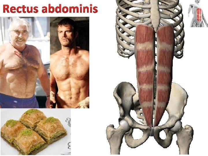 Rectus abdominis 