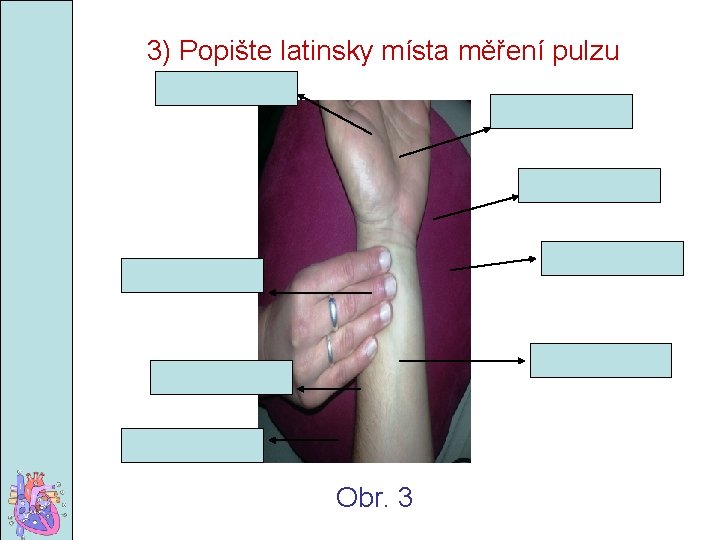 3) Popište latinsky místa měření pulzu Obr. 3 