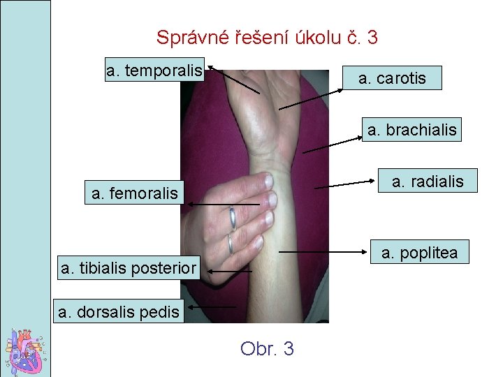 Správné řešení úkolu č. 3 a. temporalis a. carotis a. brachialis a. radialis a.