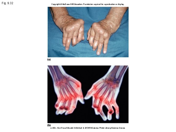 Fig. 9. 32 Copyright © Mc. Graw Hill Education. Permission required for reproduction or