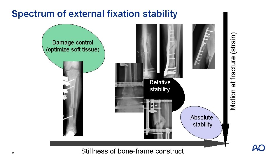 Motion at fracture (strain) Spectrum of external fixation stability Damage control (optimize soft tissue)