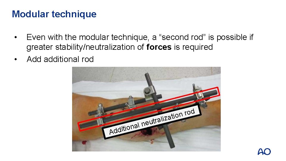 Modular technique • • Even with the modular technique, a “second rod” is possible